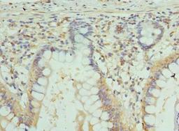Immunohistochemistry of paraffin-embedded human small intestine tissue using CSB-PA009447LA01HU at dilution of 1:100