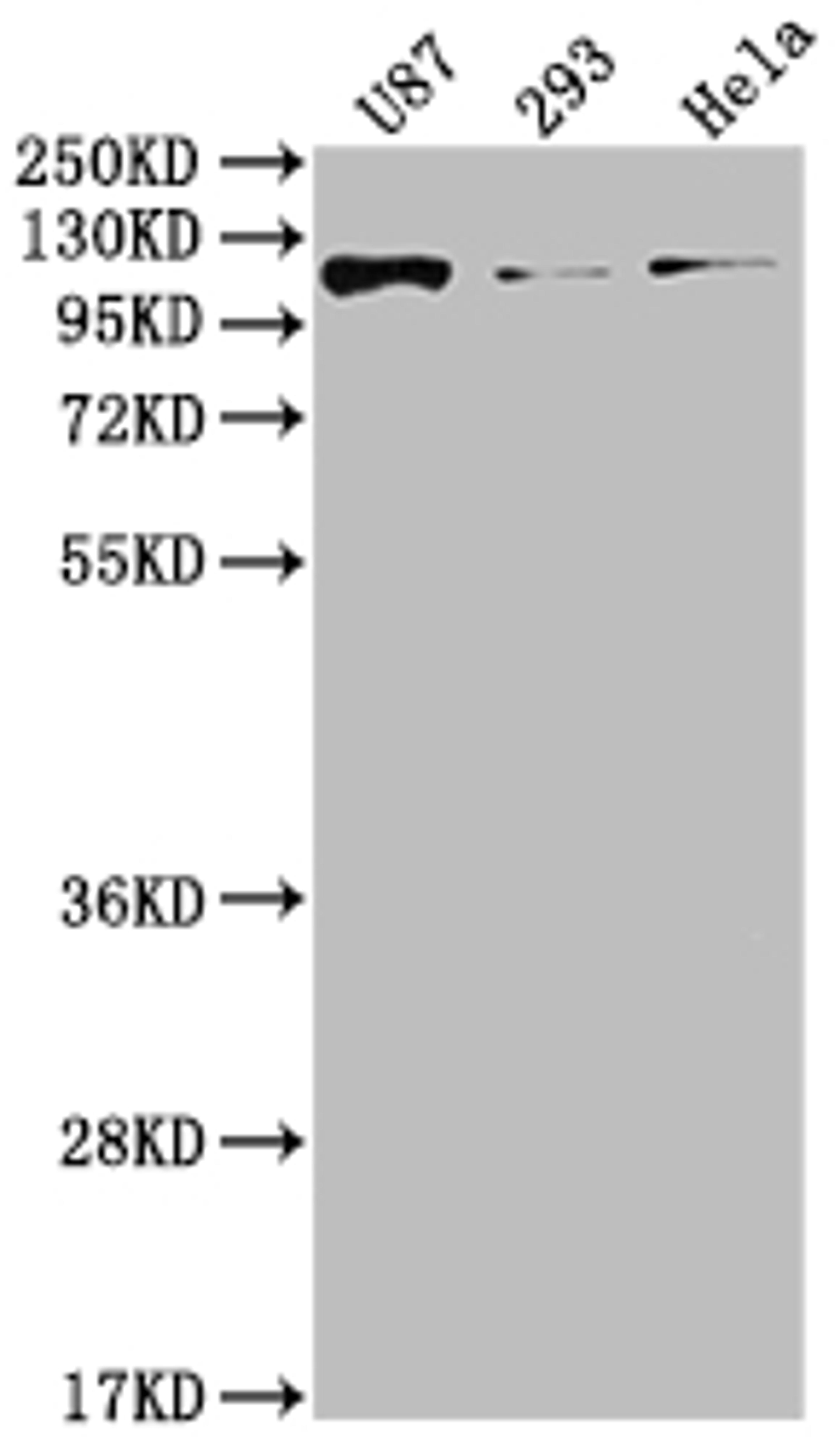 Western Blot. Positive WB detected in: U87 whole cell lysate, 293 whole cell lysate, Hela whole cell lysate. All lanes: FGFR3 antibody at 1:2000. Secondary. Goat polyclonal to rabbit IgG at 1/50000 dilution. Predicted band size: 88, 89, 76, 86 kDa. Observed band size: 115 kDa. 