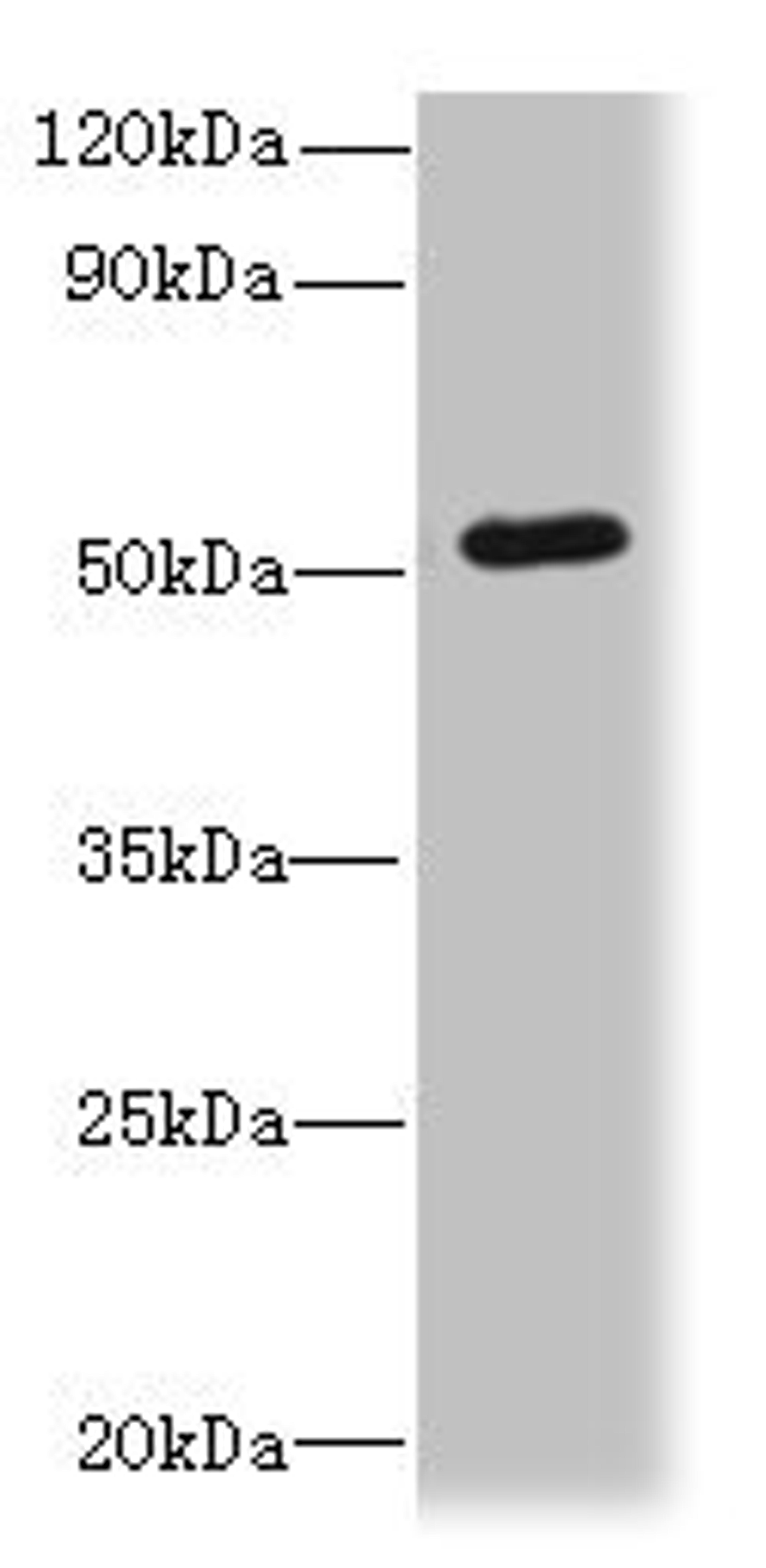 Western blot. All lanes: SNX6 antibody at 4ug/ml + Hela whole cell lysate. Secondary. Goat polyclonal to rabbit IgG at 1/10000 dilution. Predicted band size: 47, 34 kDa. Observed band size: 47 kDa. 