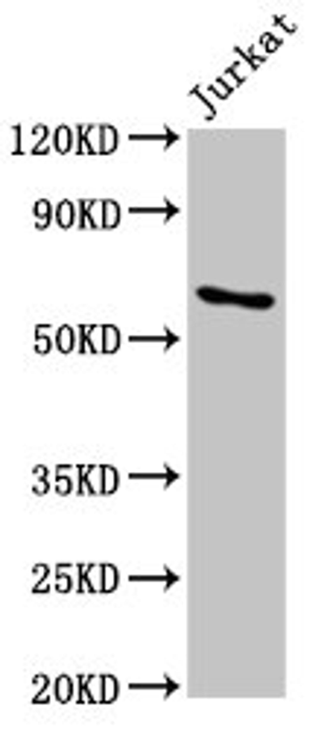 Western Blot. Positive WB detected in: Jurkat whole cell lysate. All lanes: IGF2BP1 antibody at 5.5µg/ml. Secondary. Goat polyclonal to rabbit IgG at 1/50000 dilution. Predicted band size: 64, 49 kDa. Observed band size: 64 kDa