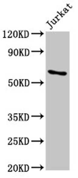 Western Blot. Positive WB detected in: Jurkat whole cell lysate. All lanes: IGF2BP1 antibody at 5.5µg/ml. Secondary. Goat polyclonal to rabbit IgG at 1/50000 dilution. Predicted band size: 64, 49 kDa. Observed band size: 64 kDa