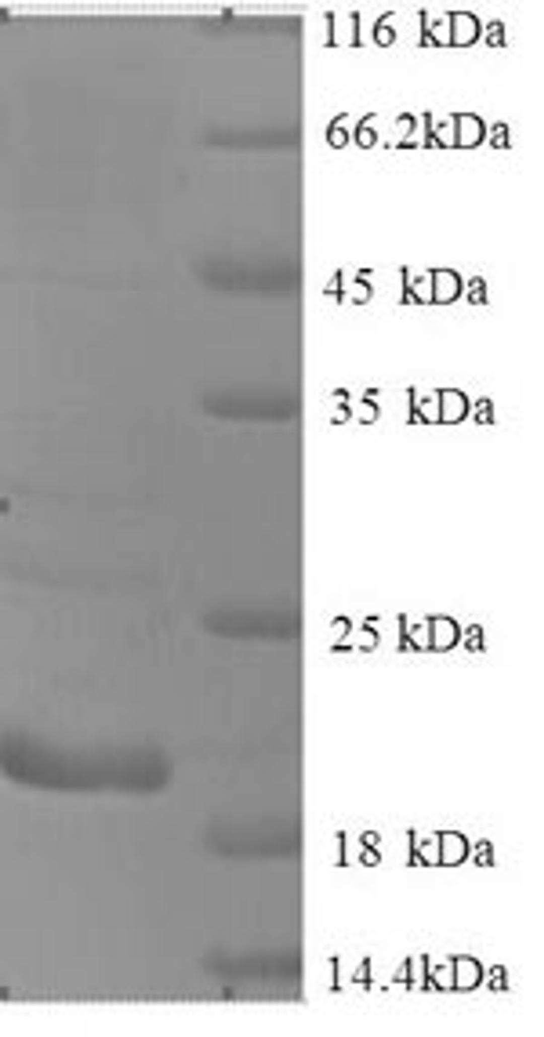 (Tris-Glycine gel) Discontinuous SDS-PAGE (reduced) with 5% enrichment gel and 15% separation gel.