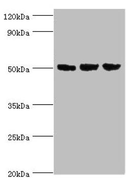Western blot. All lanes: ORC4 antibody at 4µg/ml. Lane 1: Hela whole cell lysate. Lane 2: Jurkat whole cell lysate. Lane 3: A549 whole cell lysate. Secondary. Goat polyclonal to rabbit IgG at 1/10000 dilution. Predicted band size: 51, 41, 43 kDa. Observed band size: 51 kDa