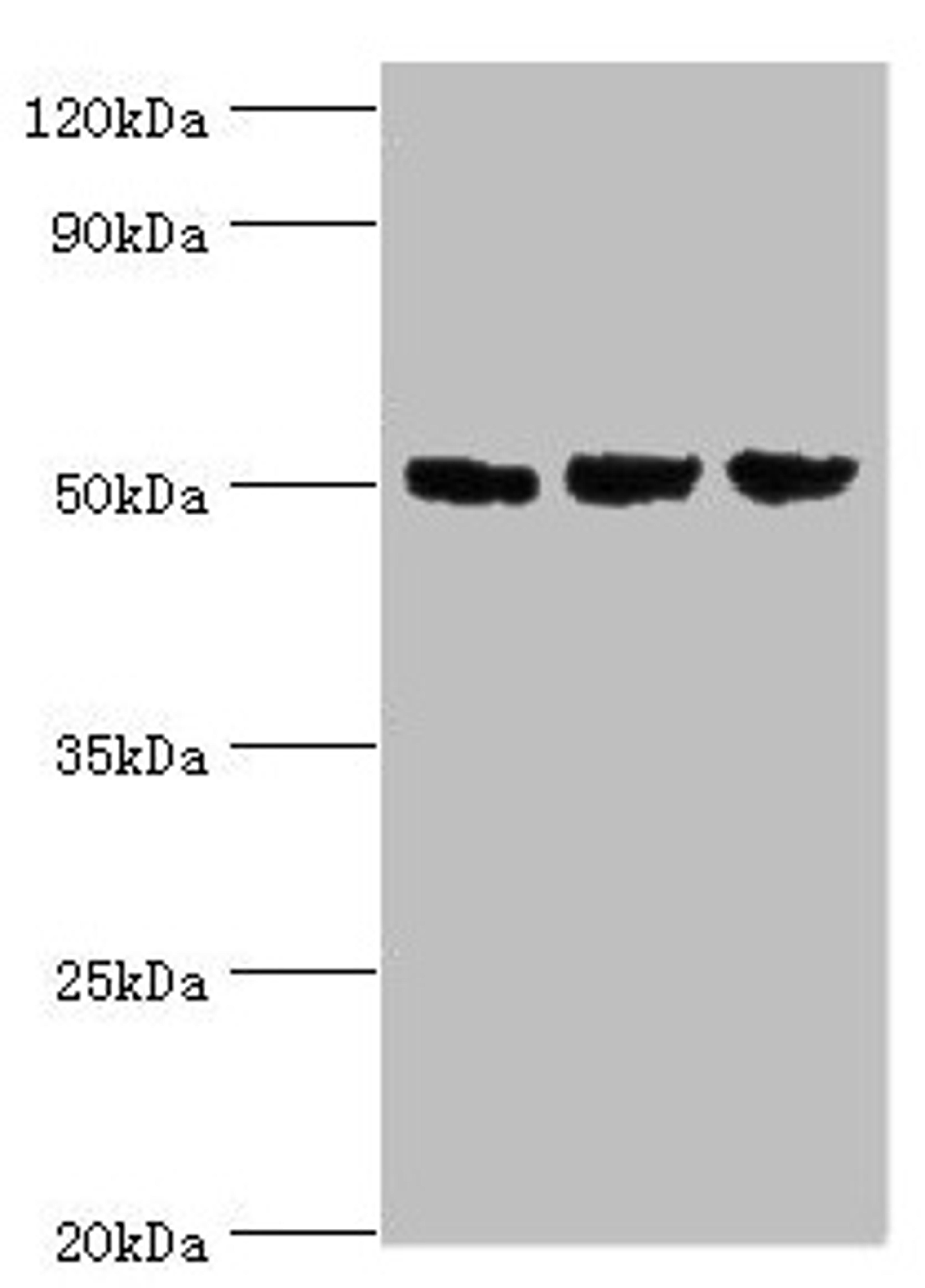 Western blot. All lanes: ORC4 antibody at 4µg/ml. Lane 1: Hela whole cell lysate. Lane 2: Jurkat whole cell lysate. Lane 3: A549 whole cell lysate. Secondary. Goat polyclonal to rabbit IgG at 1/10000 dilution. Predicted band size: 51, 41, 43 kDa. Observed band size: 51 kDa