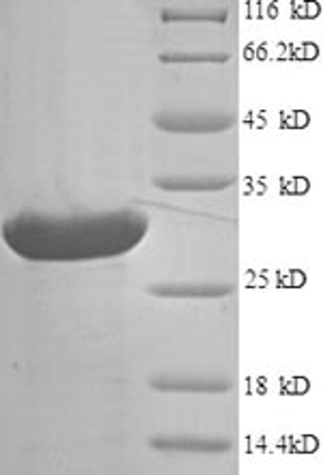 (Tris-Glycine gel) Discontinuous SDS-PAGE (reduced) with 5% enrichment gel and 15% separation gel.