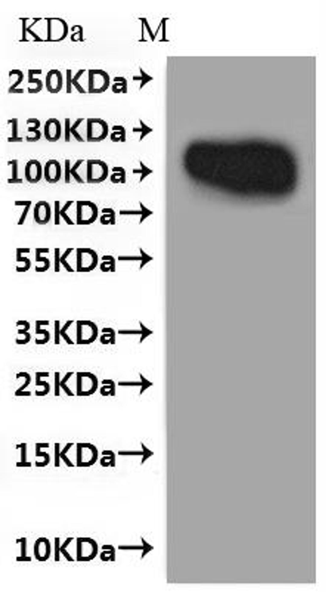CSB-MP004894HU(A4)f4 is detected by Mouse anti-GFP monoclonal antibody.