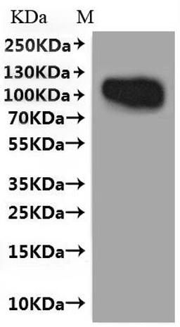 CSB-MP004894HU(A4)f4 is detected by Mouse anti-GFP monoclonal antibody.