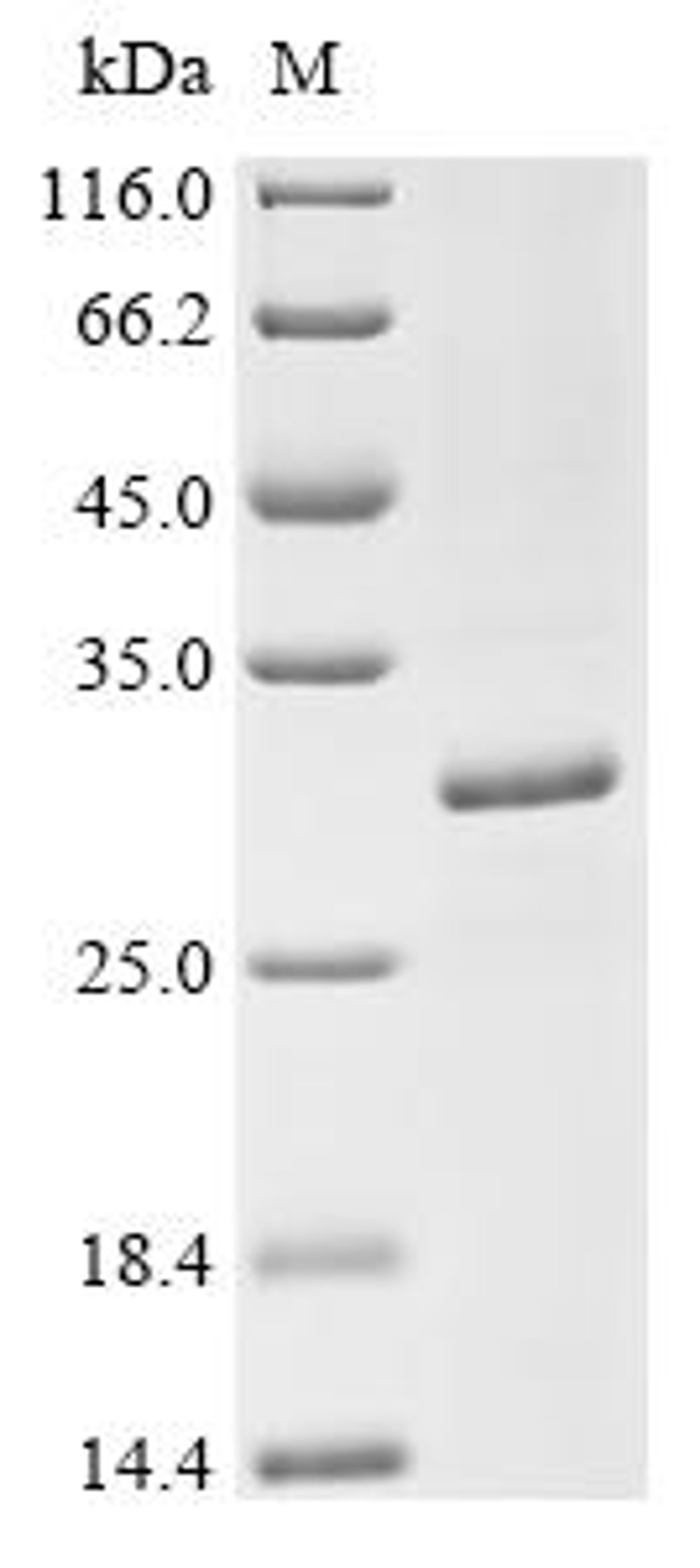 (Tris-Glycine gel) Discontinuous SDS-PAGE (reduced) with 5% enrichment gel and 15% separation gel.
