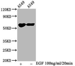 Western Blot. Positive WB detected in A549 whole cell lysate(treated with EGF or not). All lanes Phospho-PAK1/PAK2/PAK3 antibody at 1.2μg/ml. Secondary. Goat polyclonal to rabbit IgG at 1/50000 dilution. Predicted band size: 65 KDa. Observed band size: 65 KDa. 
