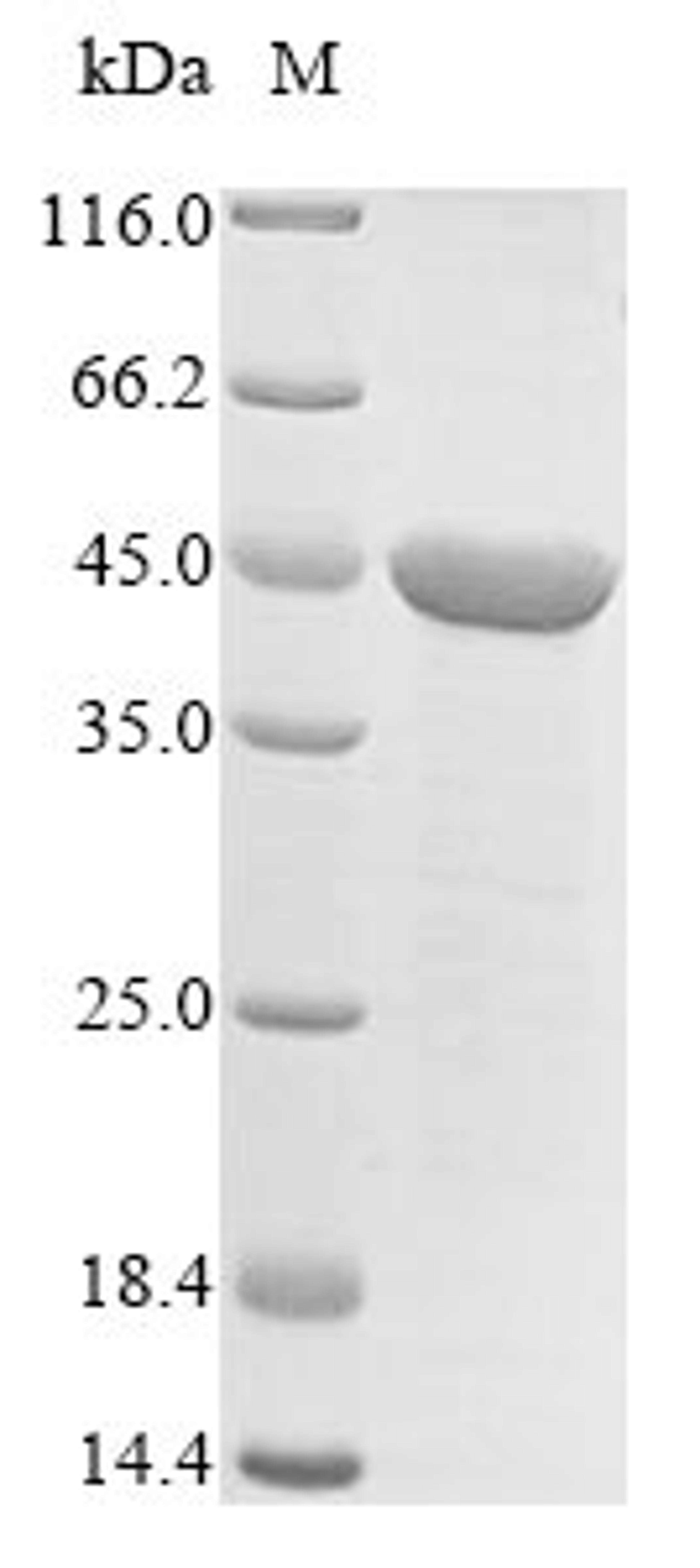 (Tris-Glycine gel) Discontinuous SDS-PAGE (reduced) with 5% enrichment gel and 15% separation gel.