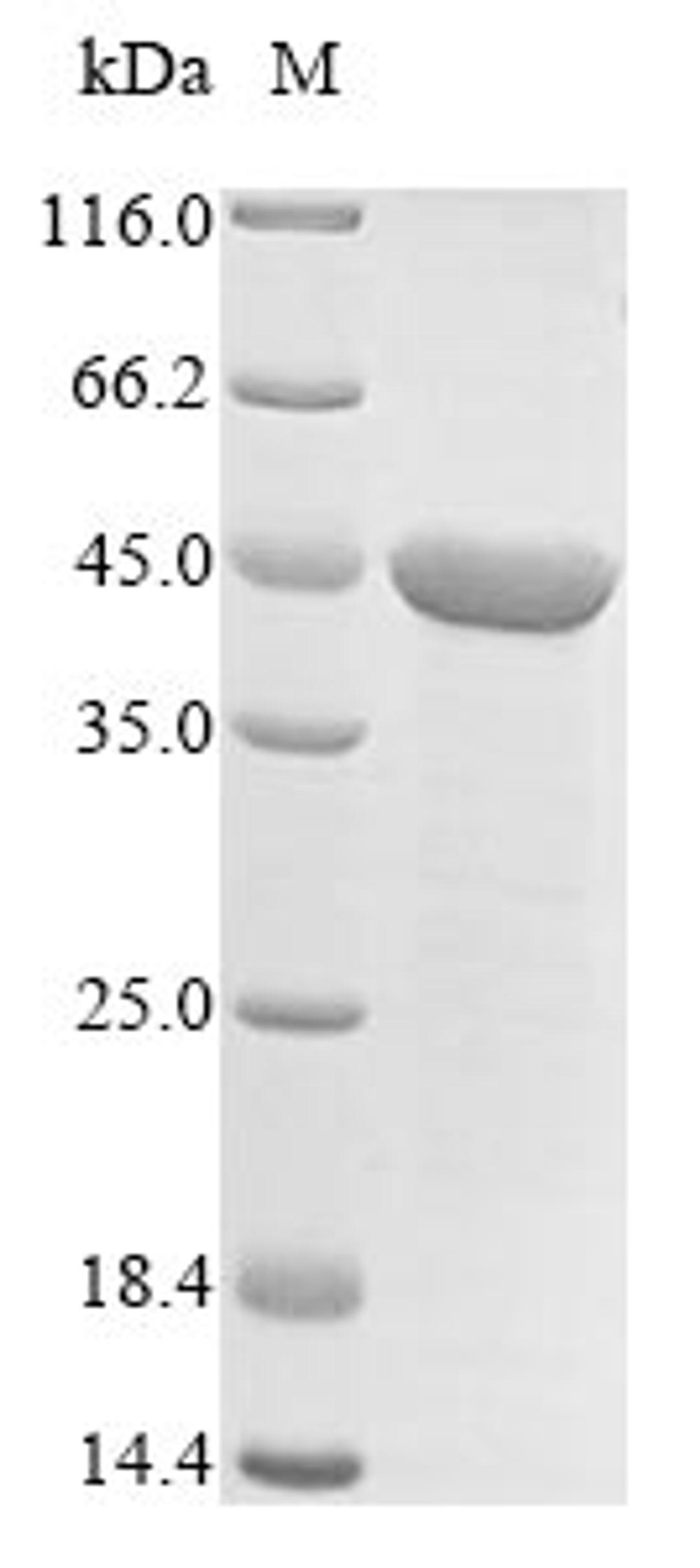 (Tris-Glycine gel) Discontinuous SDS-PAGE (reduced) with 5% enrichment gel and 15% separation gel.
