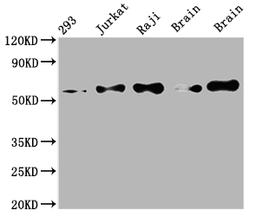 Western Blot. Positive WB detected in: 293 whole cell lysate, Jurkat whole cell lysate, Raji whole cell lysate, Mouse brain tissue, Rat brain tissue. All lanes: PAK2 antibody at 1:2000. Secondary. Goat polyclonal to rabbit IgG at 1/50000 dilution. Predicted band size: 59 kDa. Observed band size: 59 kDa. 
