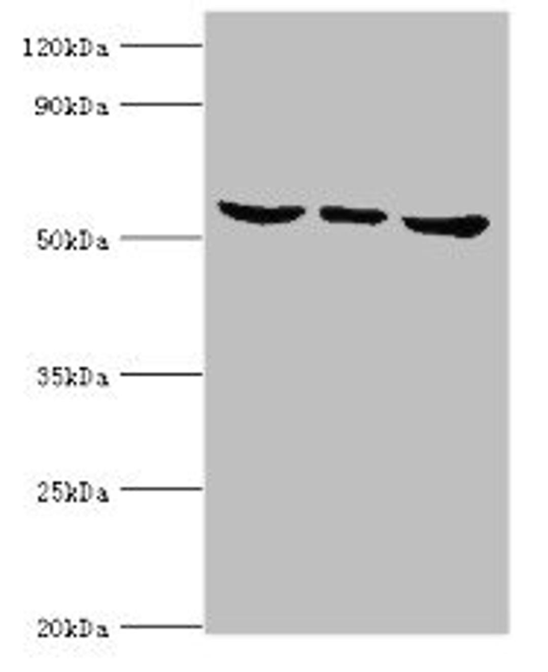 Western blot. All lanes: MAPK15 antibody at 6ug/ml. Lane 1: Hela whole cell lysate. Lane 2: MCF-7 whole cell lysate. Lane 3: HepG2 whole cell lysate. Secondary. Goat polyclonal to rabbit IgG at 1/10000 dilution. Predicted band size: 60, 29, 32 kDa. Observed band size: 60 kDa. 