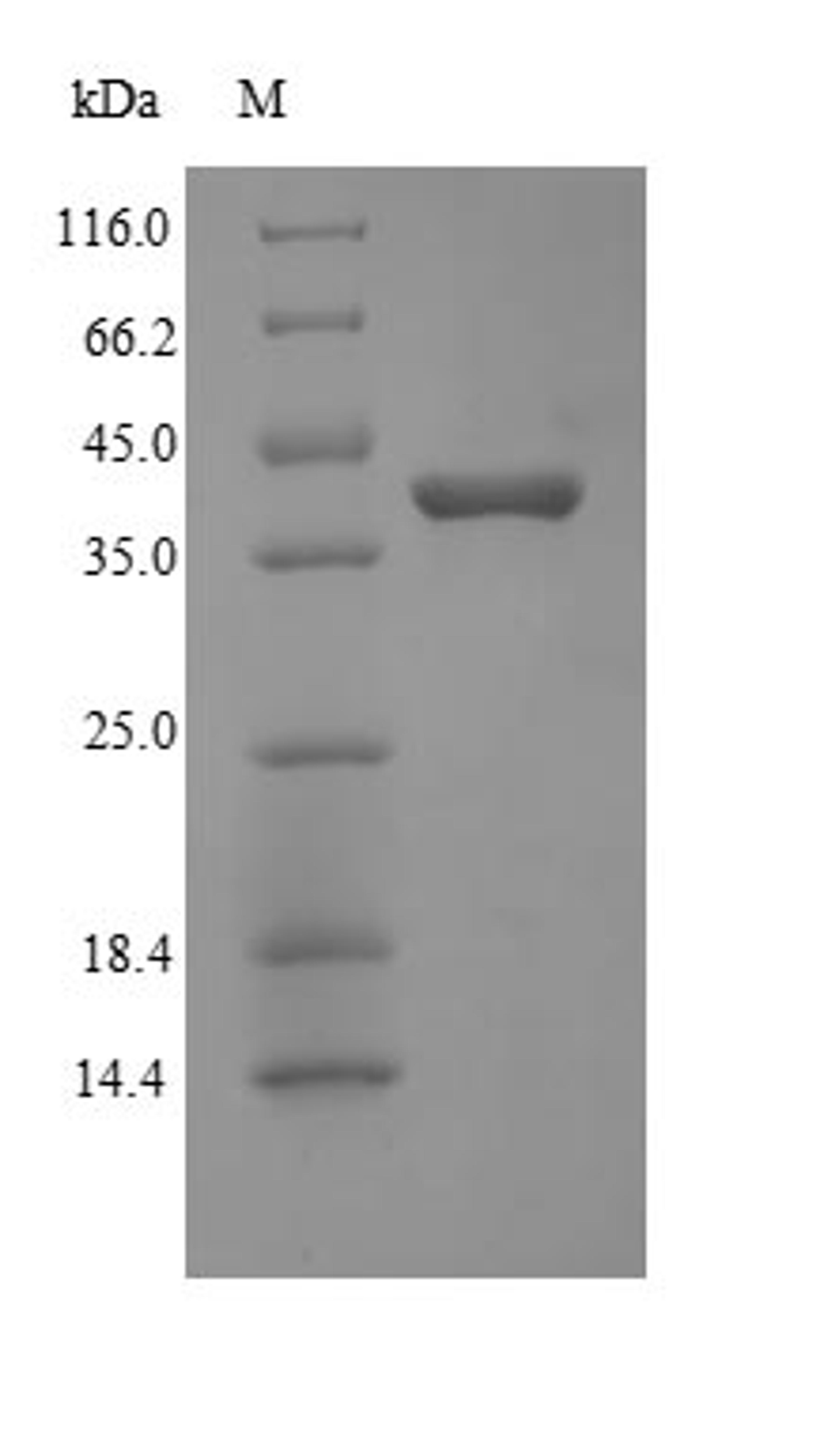 (Tris-Glycine gel) Discontinuous SDS-PAGE (reduced) with 5% enrichment gel and 15% separation gel.