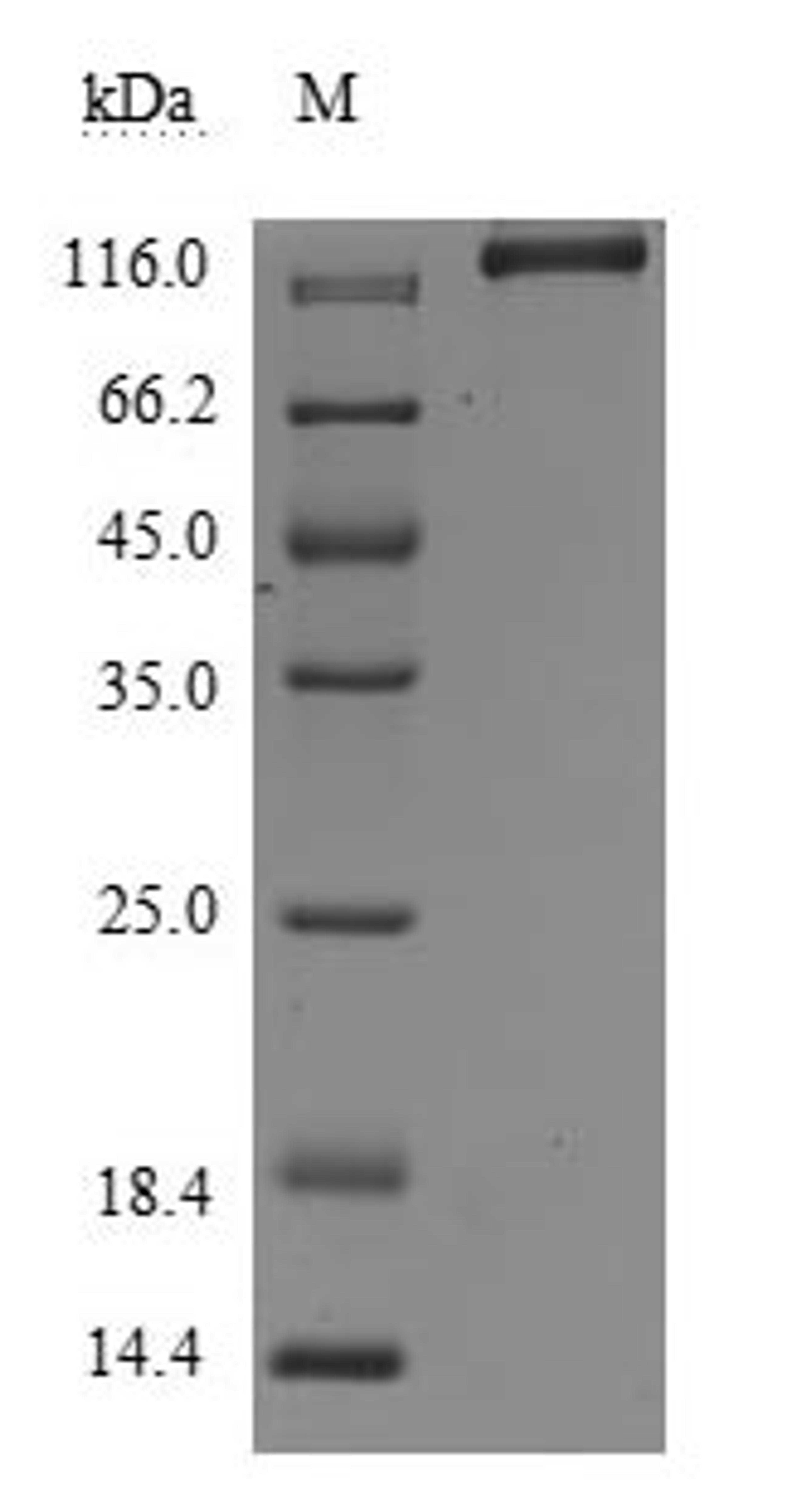 (Tris-Glycine gel) Discontinuous SDS-PAGE (reduced) with 5% enrichment gel and 15% separation gel.