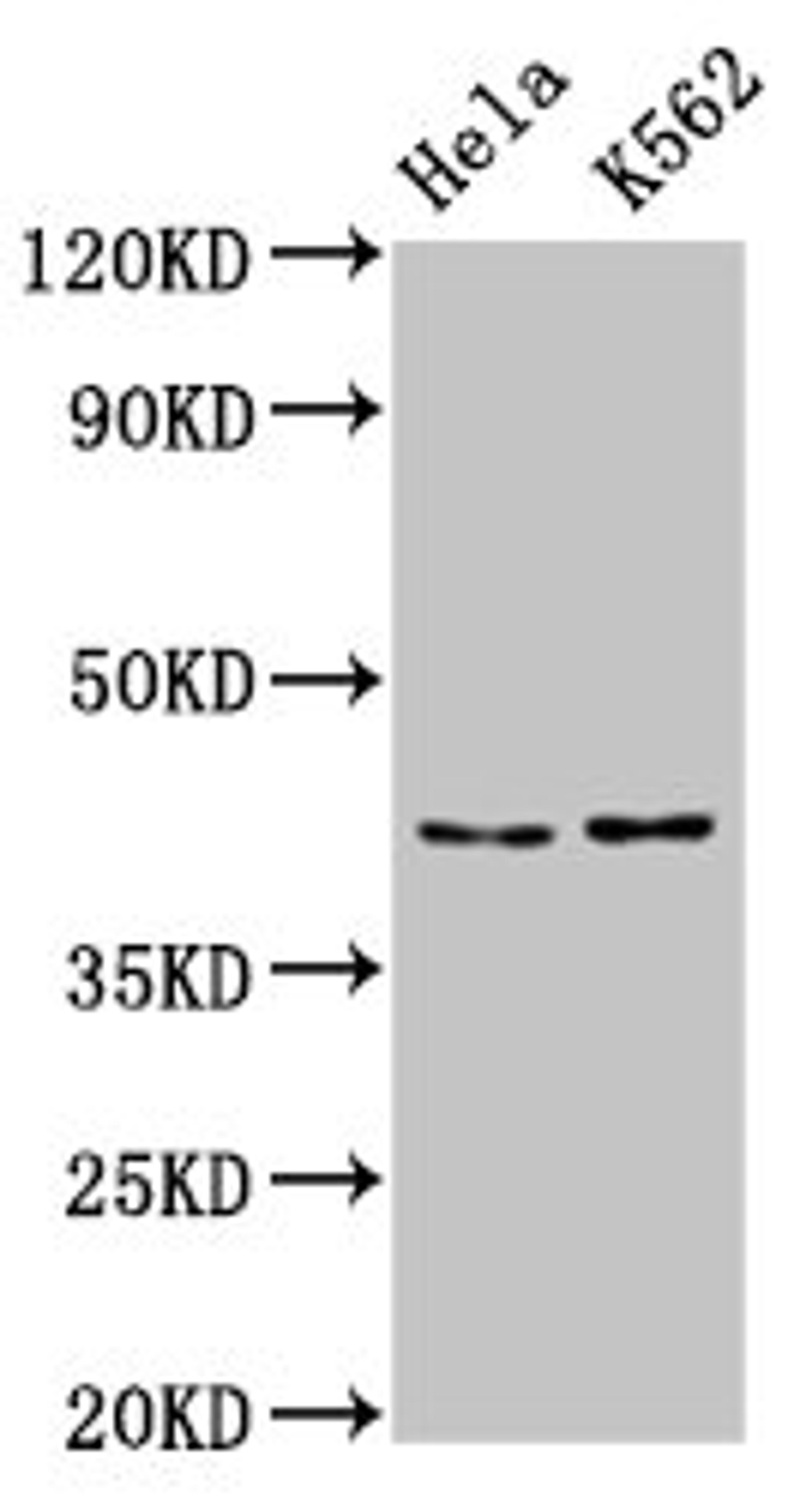 Western Blot. Positive WB detected in: Hela whole cell lysate, K562 whole cell lysate. All lanes: PCBP2 antibody at 5.3µg/ml. Secondary. Goat polyclonal to rabbit IgG at 1/50000 dilution. Predicted band size: 39, 35, 36, 34 kDa. Observed band size: 43 kDa