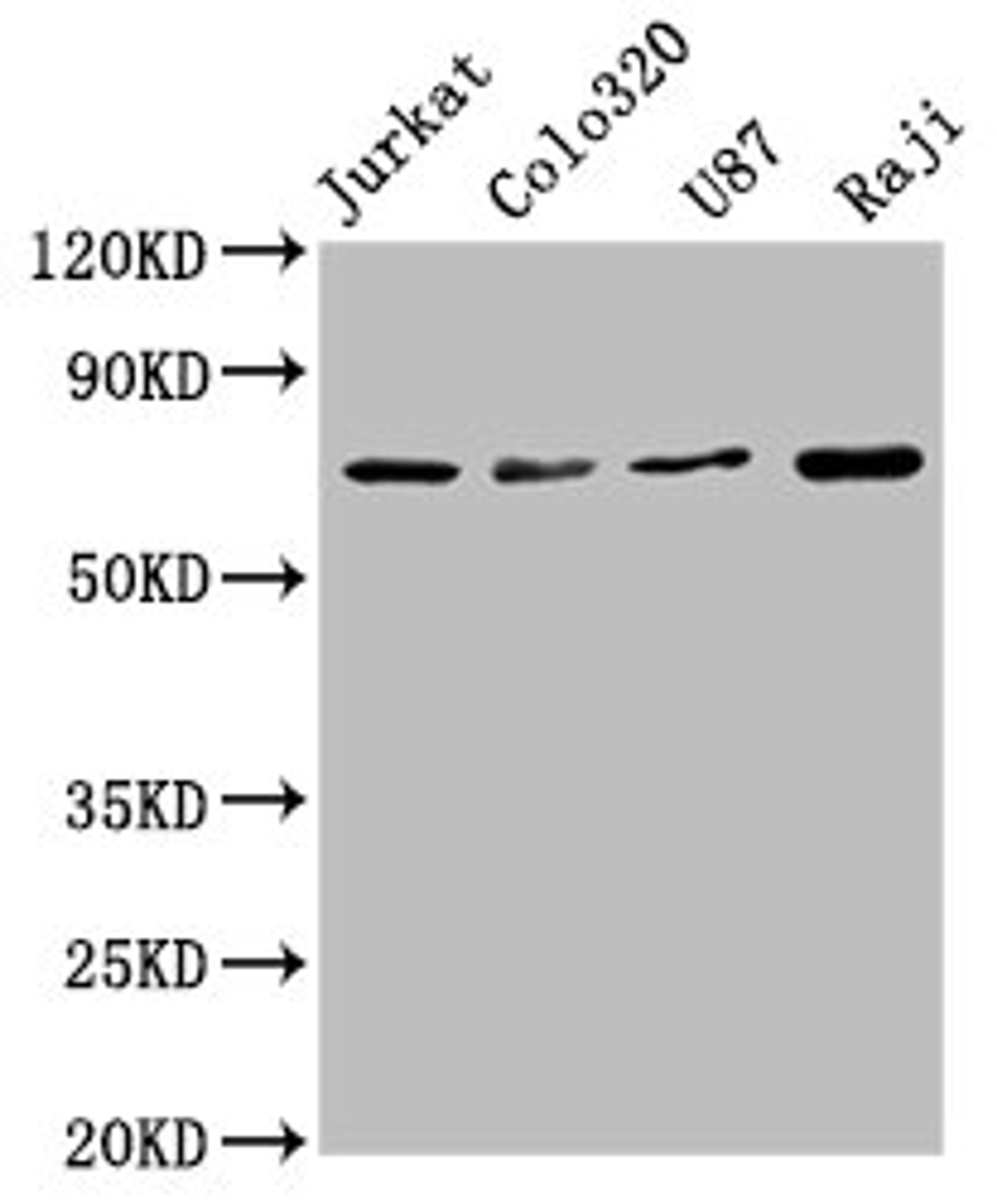 Western Blot. Positive WB detected in: Jurkat whole cell lysate, Colo320 whole cell lysate, U87 whole cell lysate, Raji whole cell lysate. All lanes: HSPA8 antibody at 1.72μg/ml. Secondary. Goat polyclonal to rabbit IgG at 1/50000 dilution. Predicted band size: 71, 54 KDa. Observed band size: 71 KDa. 
