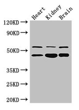 Western Blot. Positive WB detected in: Mouse heart tissue, , Mouse kidney tissue, Mouse brain tissue. All lanes: HNF4A antibody at 3ug/ml. Secondary. Goat polyclonal to rabbit IgG at 1/50000 dilution. Predicted band size: 53, 52, 47, 57, 51, 49, 44 kDa. Observed band size: 53, 47 kDa. 