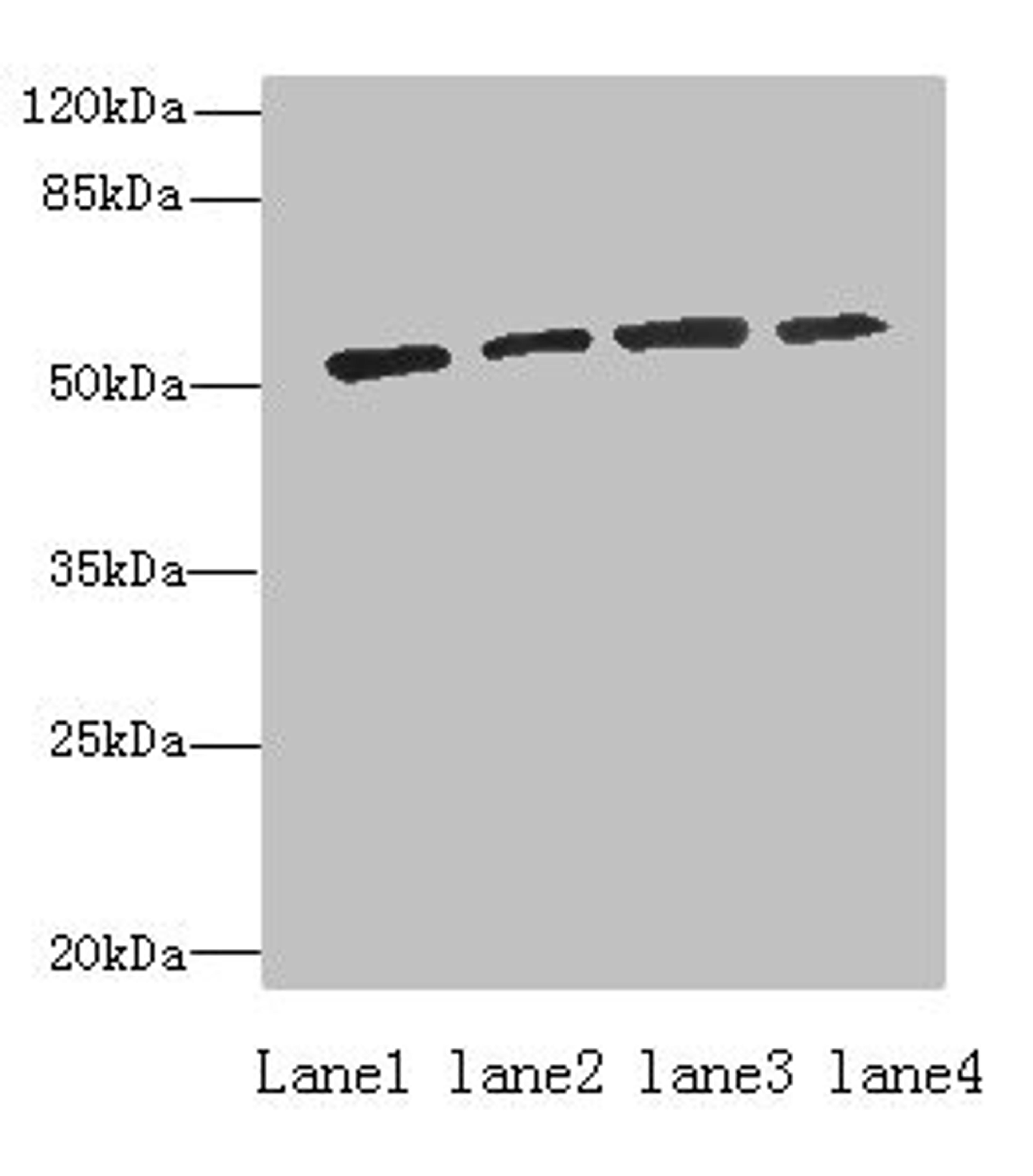 Western blot. All lanes: ETNK1 antibody at 0.5µg/ml. Lane 1: A549 whole cell lysate. Lane 2: A431 whole cell lysate. Lane 3: HepG2 whole cell lysate. Lane 4: MCF-7 whole cell lysate. Secondary. Goat polyclonal to rabbit IgG at 1/10000 dilution. Predicted band size: 51, 28 kDa. Observed band size: 51 kDa