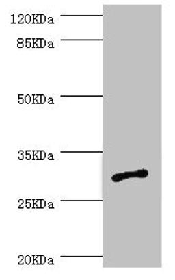 Western blot. All lanes: AGPAT2 antibody at 1.09ug/ml + Jurkat whole cell lysate. Secondary. Goat polyclonal to rabbit IgG at 1/10000 dilution. Predicted band size: 31, 28 kDa. Observed band size: 31 kDa. 