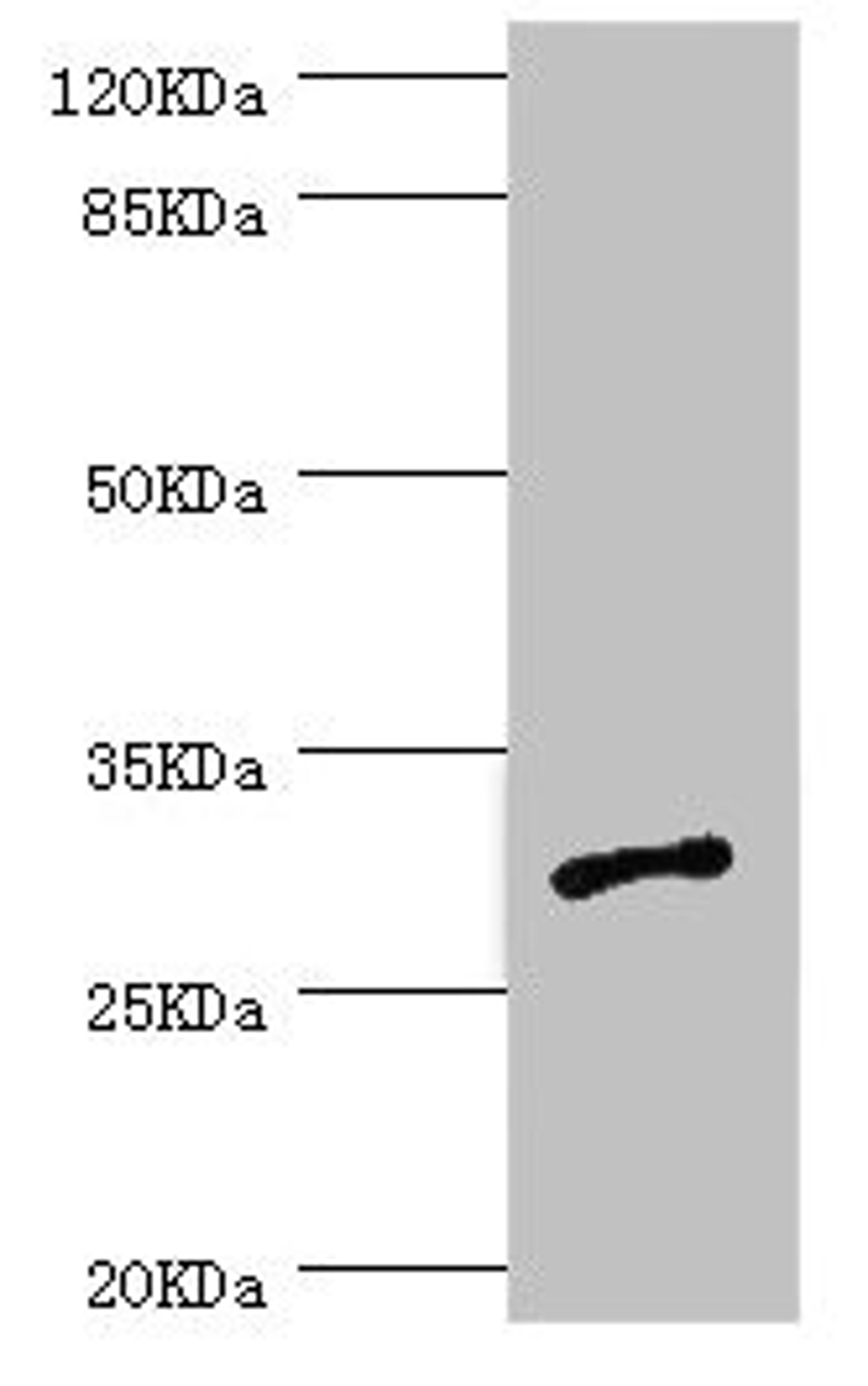 Western blot. All lanes: AGPAT2 antibody at 1.09ug/ml + Jurkat whole cell lysate. Secondary. Goat polyclonal to rabbit IgG at 1/10000 dilution. Predicted band size: 31, 28 kDa. Observed band size: 31 kDa. 