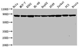 Western Blot. Positive WB detected in: Hela whole cell lysate, MCF-7 whole cell lysate, K562 whole cell lysate, HL-60 whole cell lysate, HepG2 whole cell lysate, A549 whole cell lysate, Jurkat whole cell lysate, PC3 whole cell lysate, Rat brain tissue. All lanes: Hsp90 alpha antibody at 0.8μg/ml. Secondary. Goat polyclonal to rabbit IgG at 1/50000 dilution. Predicted band size: 85, 99 KDa. Observed band size: 85 KDa.