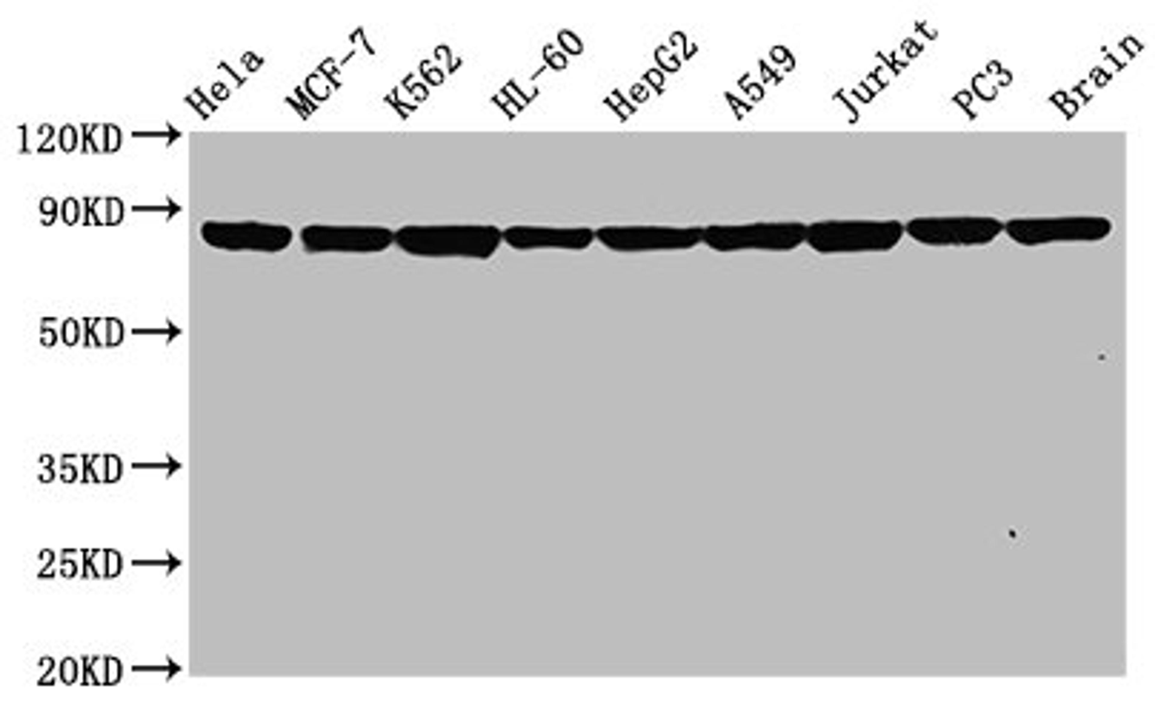 Western Blot. Positive WB detected in: Hela whole cell lysate, MCF-7 whole cell lysate, K562 whole cell lysate, HL-60 whole cell lysate, HepG2 whole cell lysate, A549 whole cell lysate, Jurkat whole cell lysate, PC3 whole cell lysate, Rat brain tissue. All lanes: Hsp90 alpha antibody at 0.8μg/ml. Secondary. Goat polyclonal to rabbit IgG at 1/50000 dilution. Predicted band size: 85, 99 KDa. Observed band size: 85 KDa.