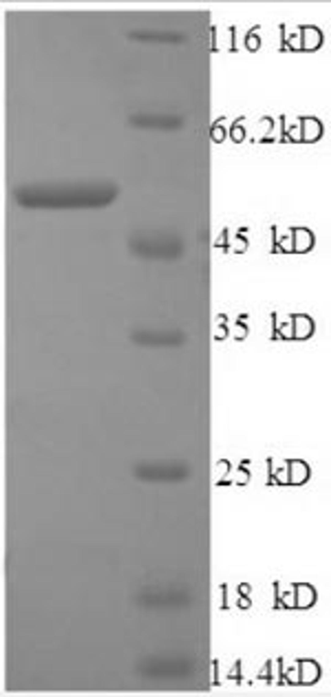 (Tris-Glycine gel) Discontinuous SDS-PAGE (reduced) with 5% enrichment gel and 15% separation gel.
