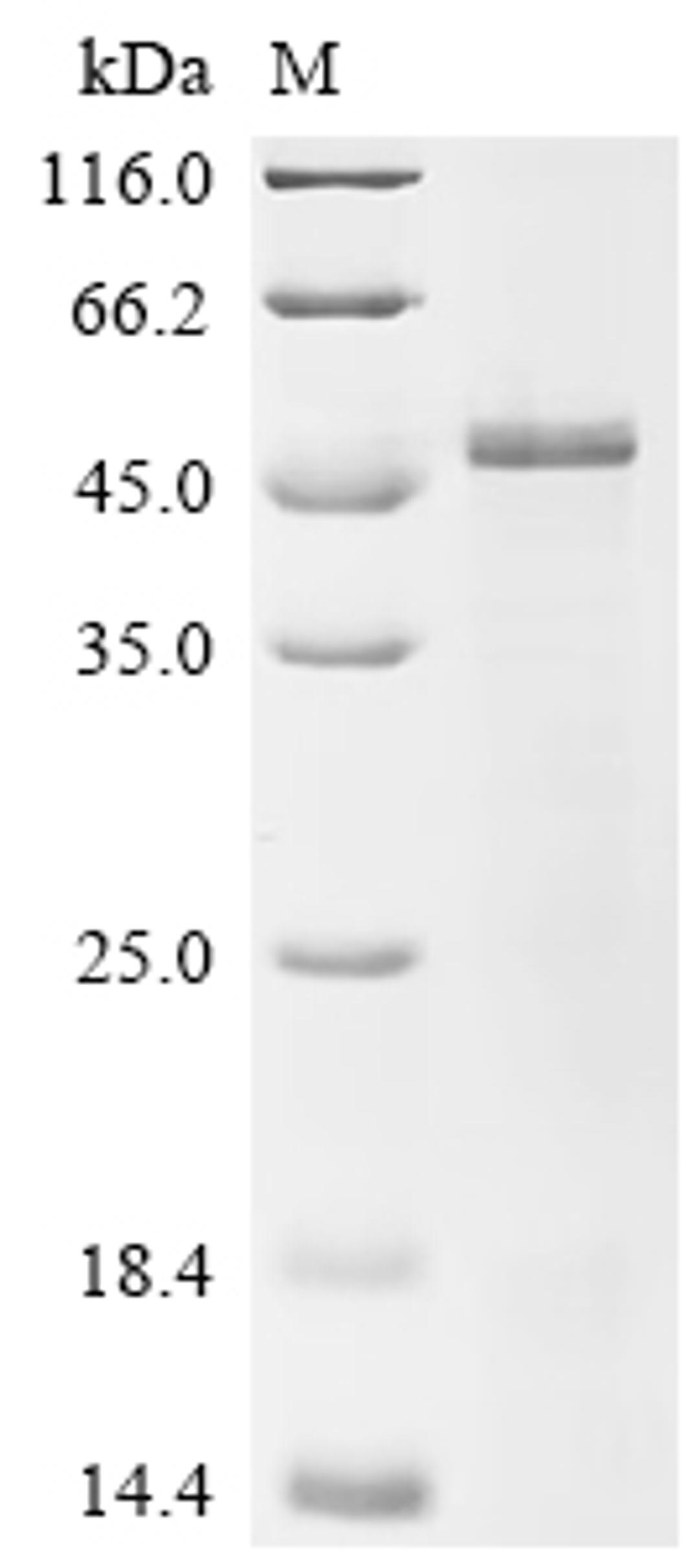(Tris-Glycine gel) Discontinuous SDS-PAGE (reduced) with 5% enrichment gel and 15% separation gel.