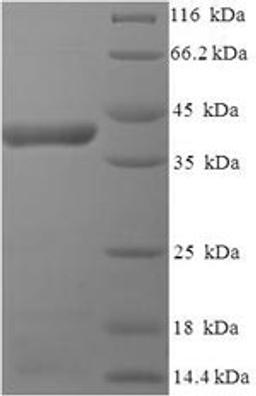 (Tris-Glycine gel) Discontinuous SDS-PAGE (reduced) with 5% enrichment gel and 15% separation gel.