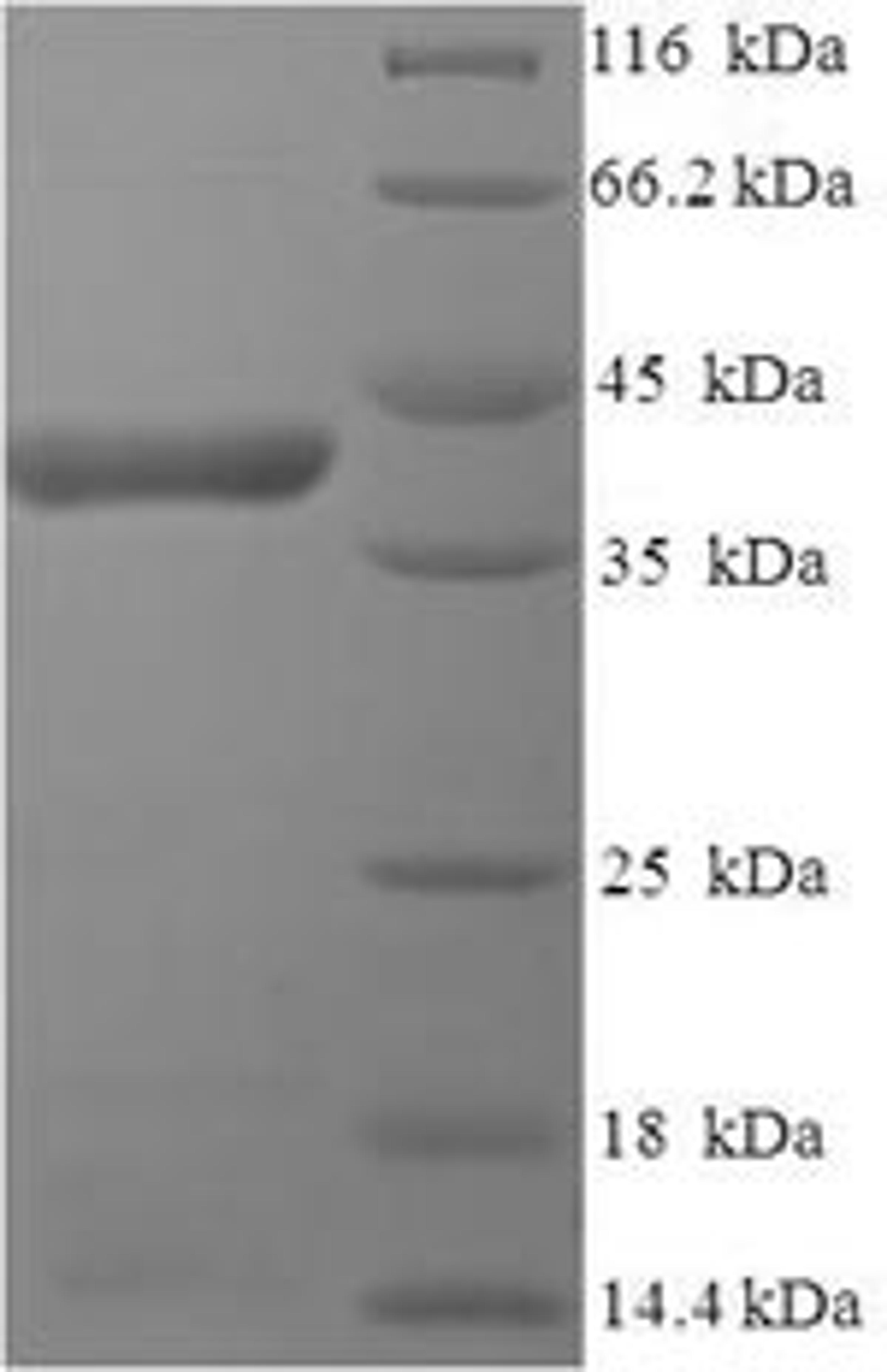 (Tris-Glycine gel) Discontinuous SDS-PAGE (reduced) with 5% enrichment gel and 15% separation gel.