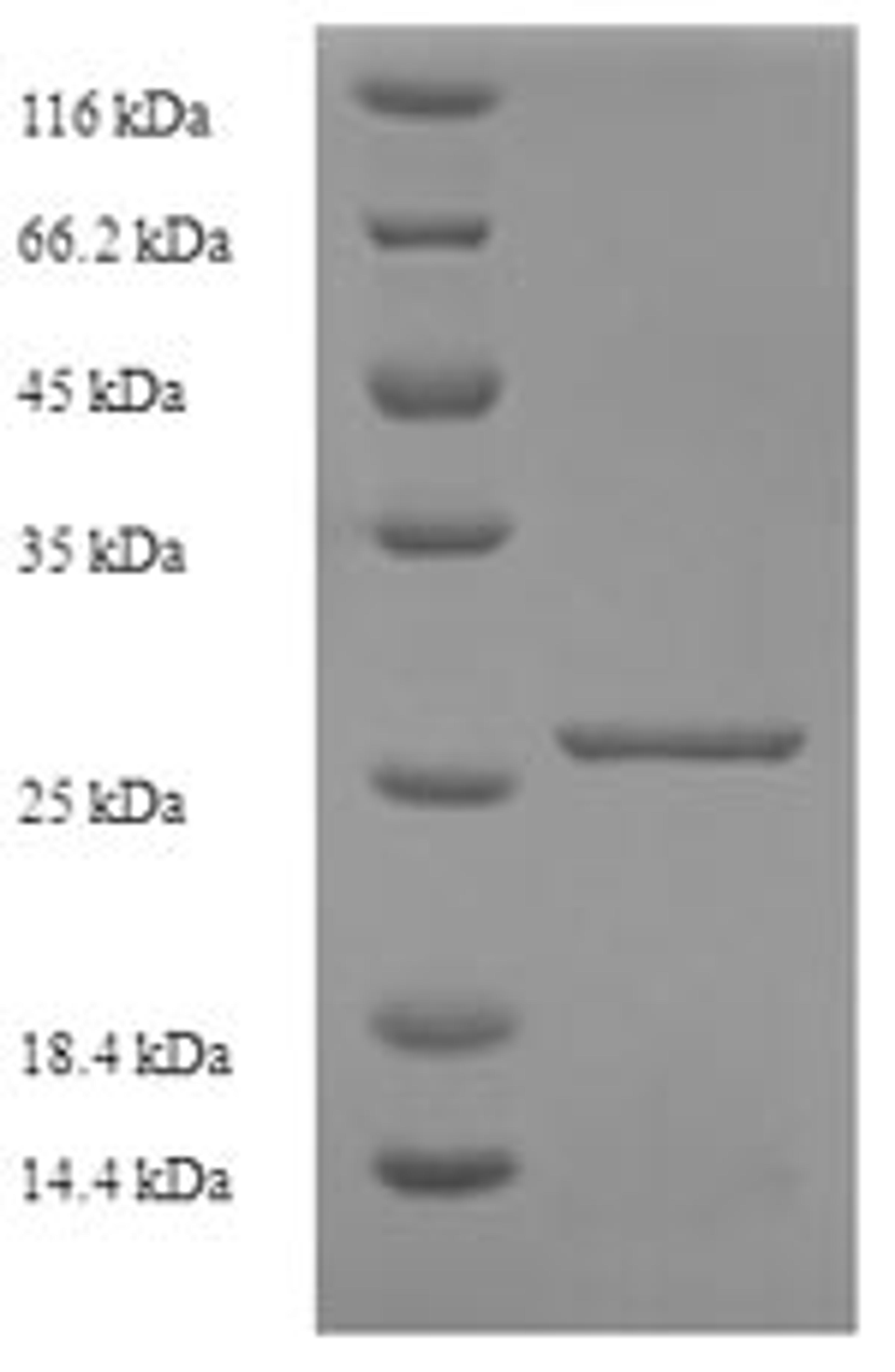 (Tris-Glycine gel) Discontinuous SDS-PAGE (reduced) with 5% enrichment gel and 15% separation gel.