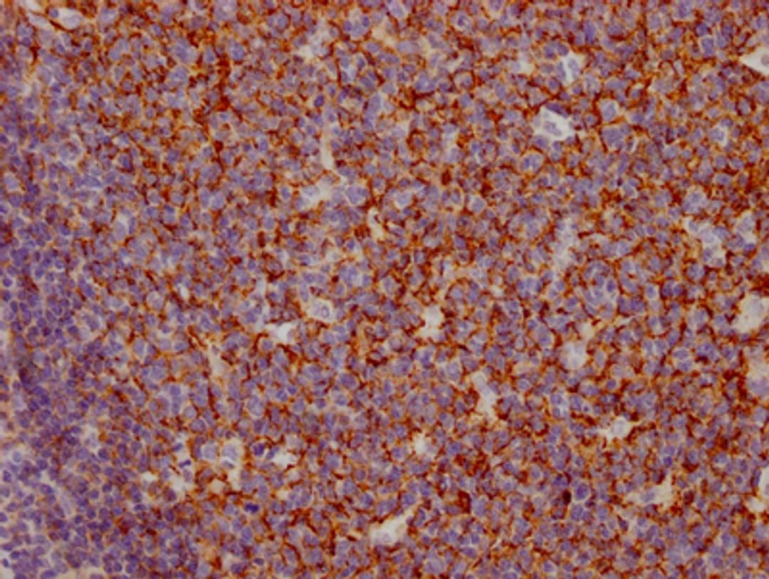 IHC image of CSB-RA714310A0HU diluted at 1:100 and staining in paraffin-embedded human tonsil tissue performed on a Leica BondTM system. After dewaxing and hydration, antigen retrieval was mediated by high pressure in a citrate buffer (pH 6.0). Section was blocked with 10% normal goat serum 30min at RT. Then primary antibody (1% BSA) was incubated at 4℃ overnight. The primary is detected by a Goat anti-rabbit IgG polymer labeled by HRP and visualized using 0.05% DAB.