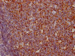 IHC image of CSB-RA714310A0HU diluted at 1:100 and staining in paraffin-embedded human tonsil tissue performed on a Leica BondTM system. After dewaxing and hydration, antigen retrieval was mediated by high pressure in a citrate buffer (pH 6.0). Section was blocked with 10% normal goat serum 30min at RT. Then primary antibody (1% BSA) was incubated at 4℃ overnight. The primary is detected by a Goat anti-rabbit IgG polymer labeled by HRP and visualized using 0.05% DAB.