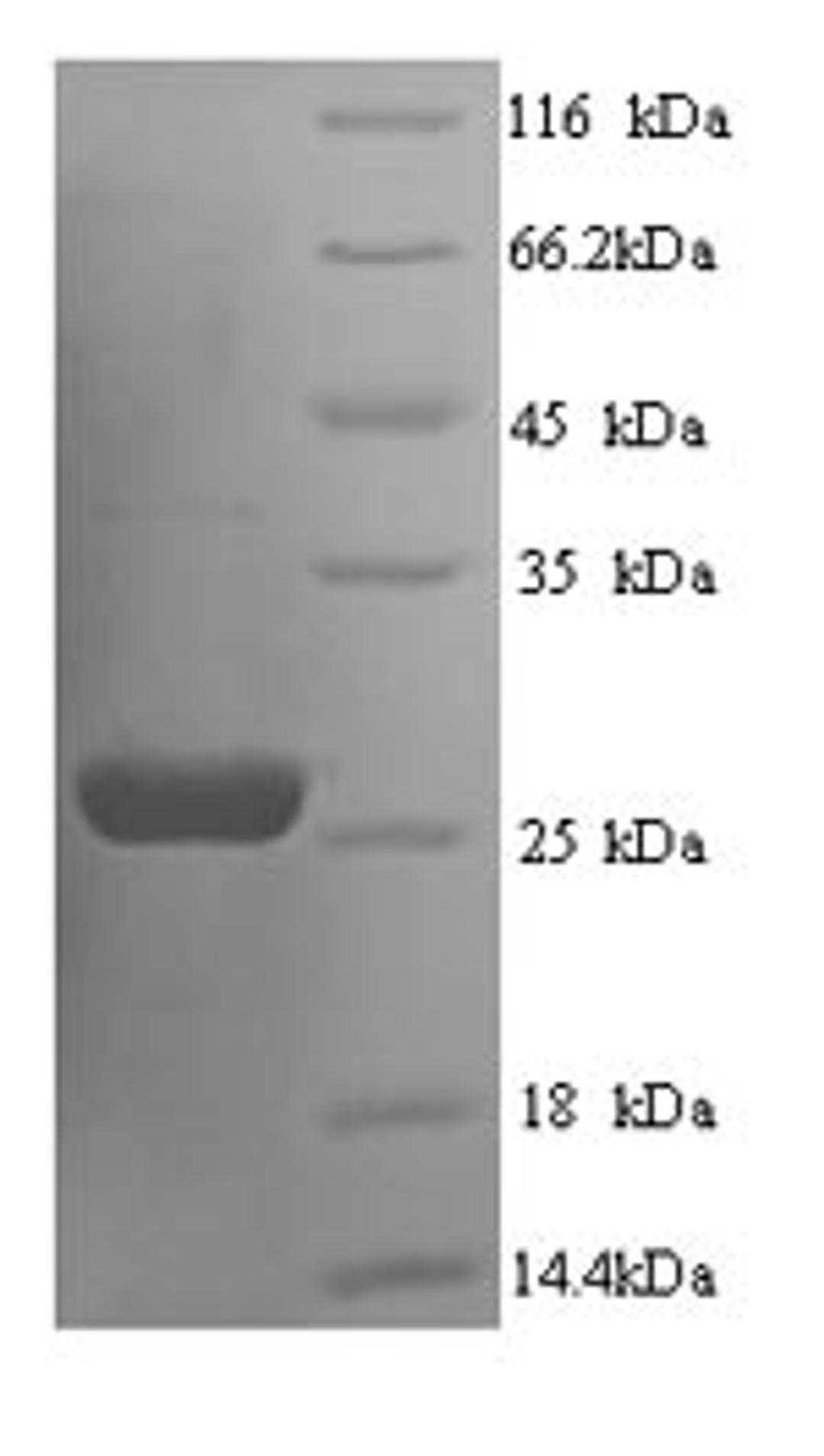 (Tris-Glycine gel) Discontinuous SDS-PAGE (reduced) with 5% enrichment gel and 15% separation gel.