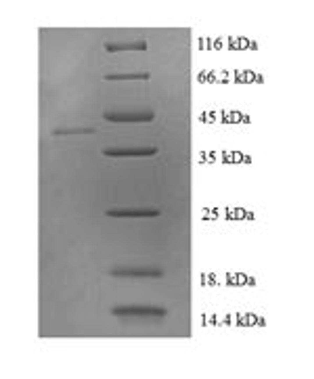 (Tris-Glycine gel) Discontinuous SDS-PAGE (reduced) with 5% enrichment gel and 15% separation gel.