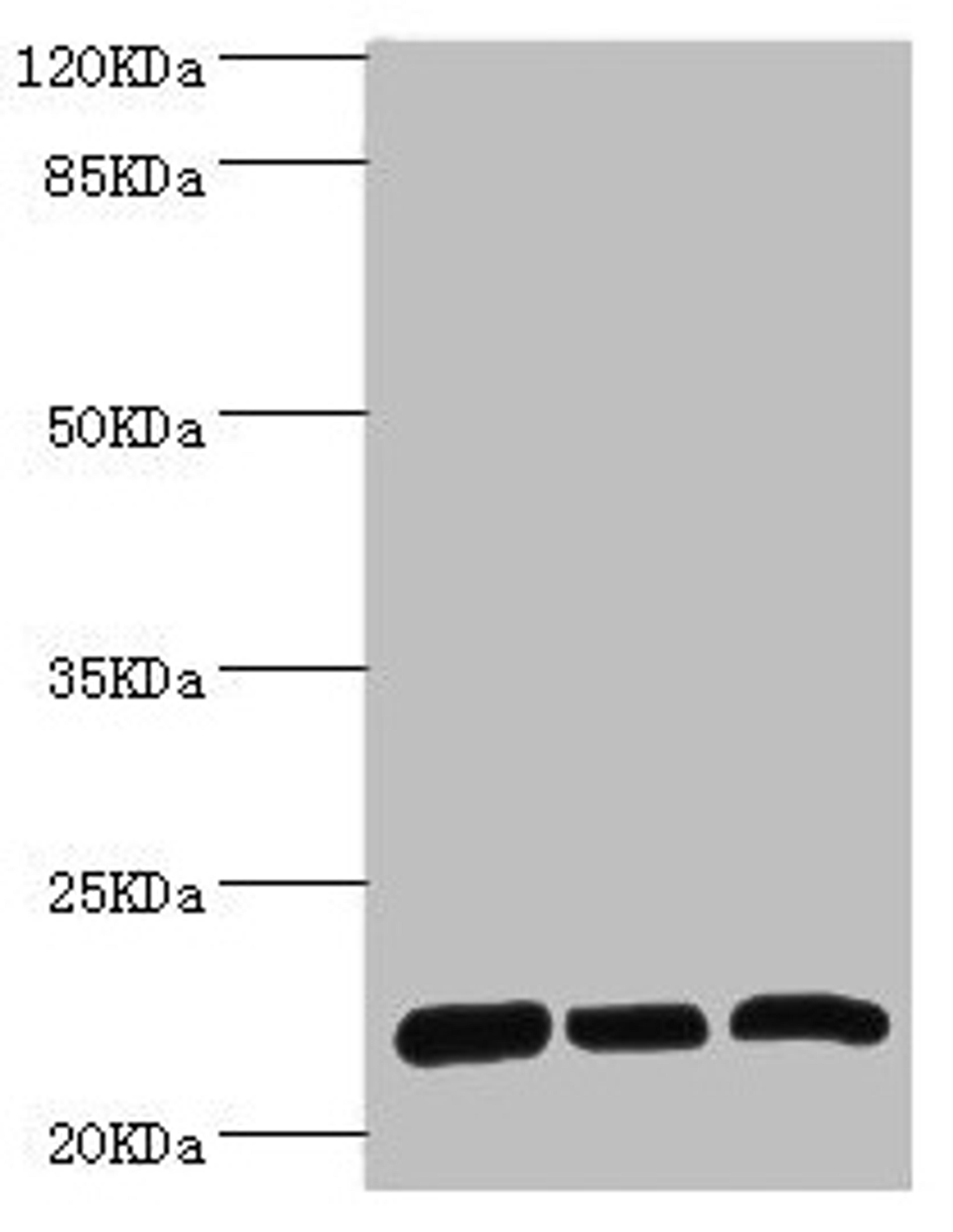 Western blot. All lanes: RPL9 antibody at 0.61µg/ml. Lane 1: SY-5Y whole cell lysate. Lane 2: Hela whole cell lysate. Lane 3: HepG2 whole cell lysate. Secondary. Goat polyclonal to rabbit IgG at 1/10000 dilution. Predicted band size: 22 kDa. Observed band size: 22 kDa