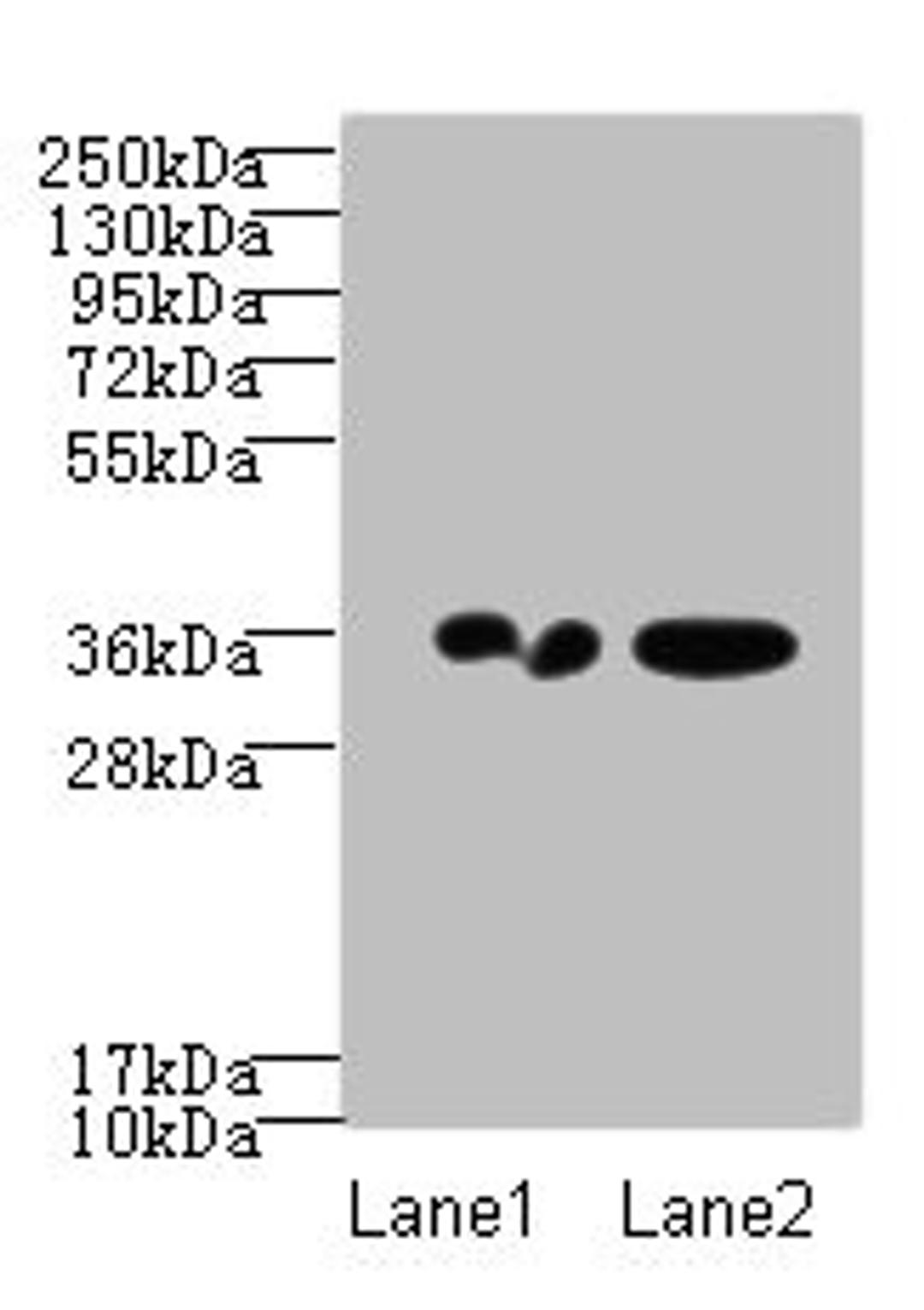 Western blot. All lanes: RPRD1A antibody at 2ug/ml. Lane 1: A431 whole cell lysate. Lane 2: Jurkat whole cell lysate. Secondary. Goat polyclonal to Rabbit IgG at 1/10000 dilution. Predicted band size: 36, 32 kDa. Observed band size: 36 kDa. 