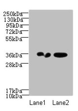 Western blot. All lanes: RPRD1A antibody at 2ug/ml. Lane 1: A431 whole cell lysate. Lane 2: Jurkat whole cell lysate. Secondary. Goat polyclonal to Rabbit IgG at 1/10000 dilution. Predicted band size: 36, 32 kDa. Observed band size: 36 kDa. 