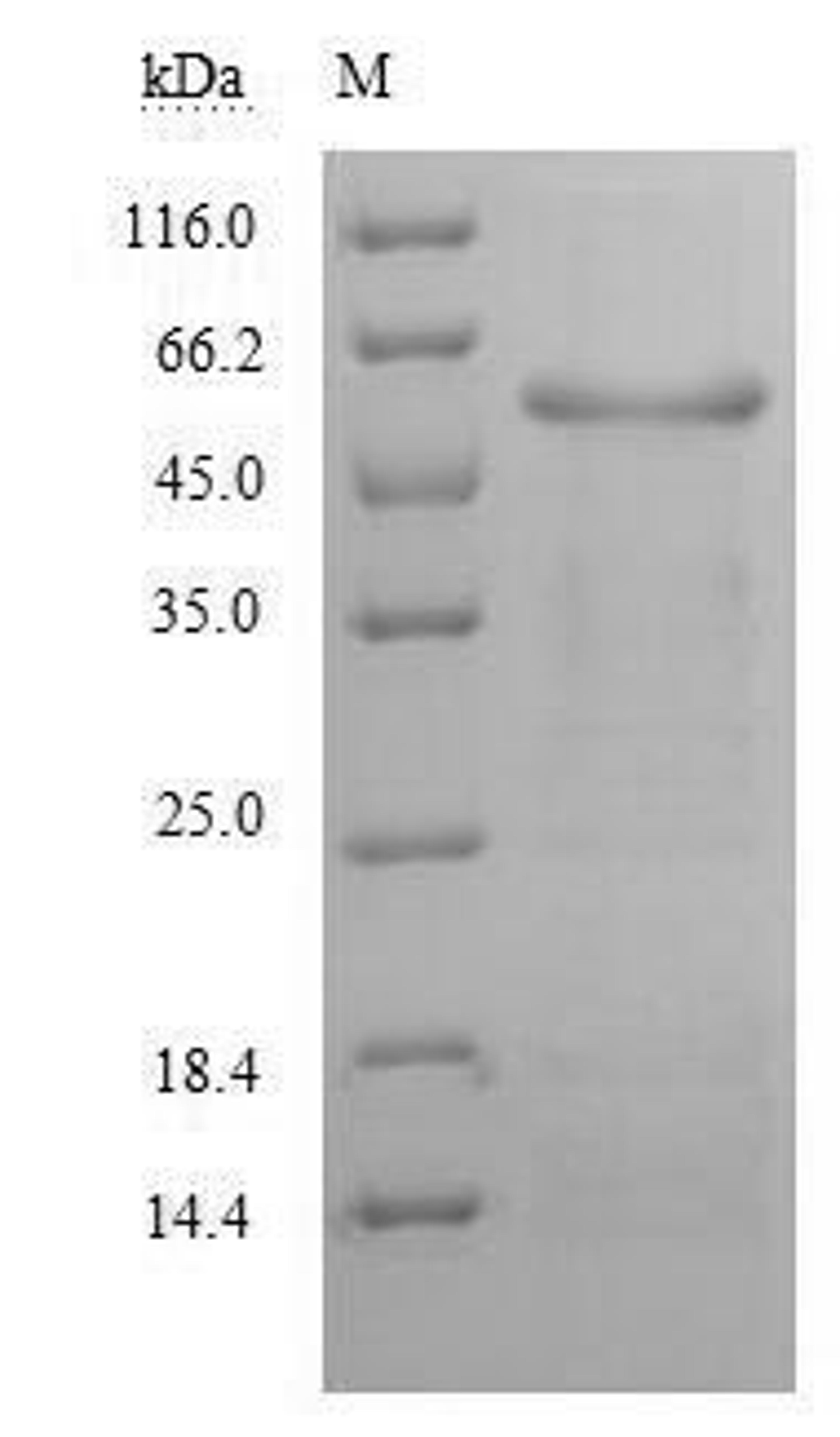 (Tris-Glycine gel) Discontinuous SDS-PAGE (reduced) with 5% enrichment gel and 15% separation gel.