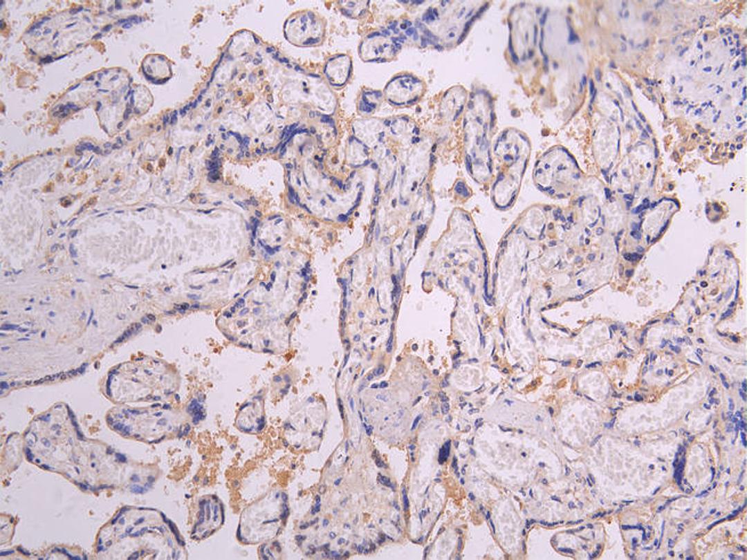 IHC image of CSB-RA018727MA1HU diluted at 1:200 and staining in paraffin-embedded human placenta tissue performed on a Leica BondTM system. After dewaxing and hydration, antigen retrieval was mediated by high pressure in a citrate buffer (pH 6.0). Section was blocked with 10% normal goat serum 30min at RT. Then primary antibody (1% BSA) was incubated at 4°C overnight. The primary is detected by a Goat anti-human polymer IgG labeled by HRP and visualized using 0.05% DAB.