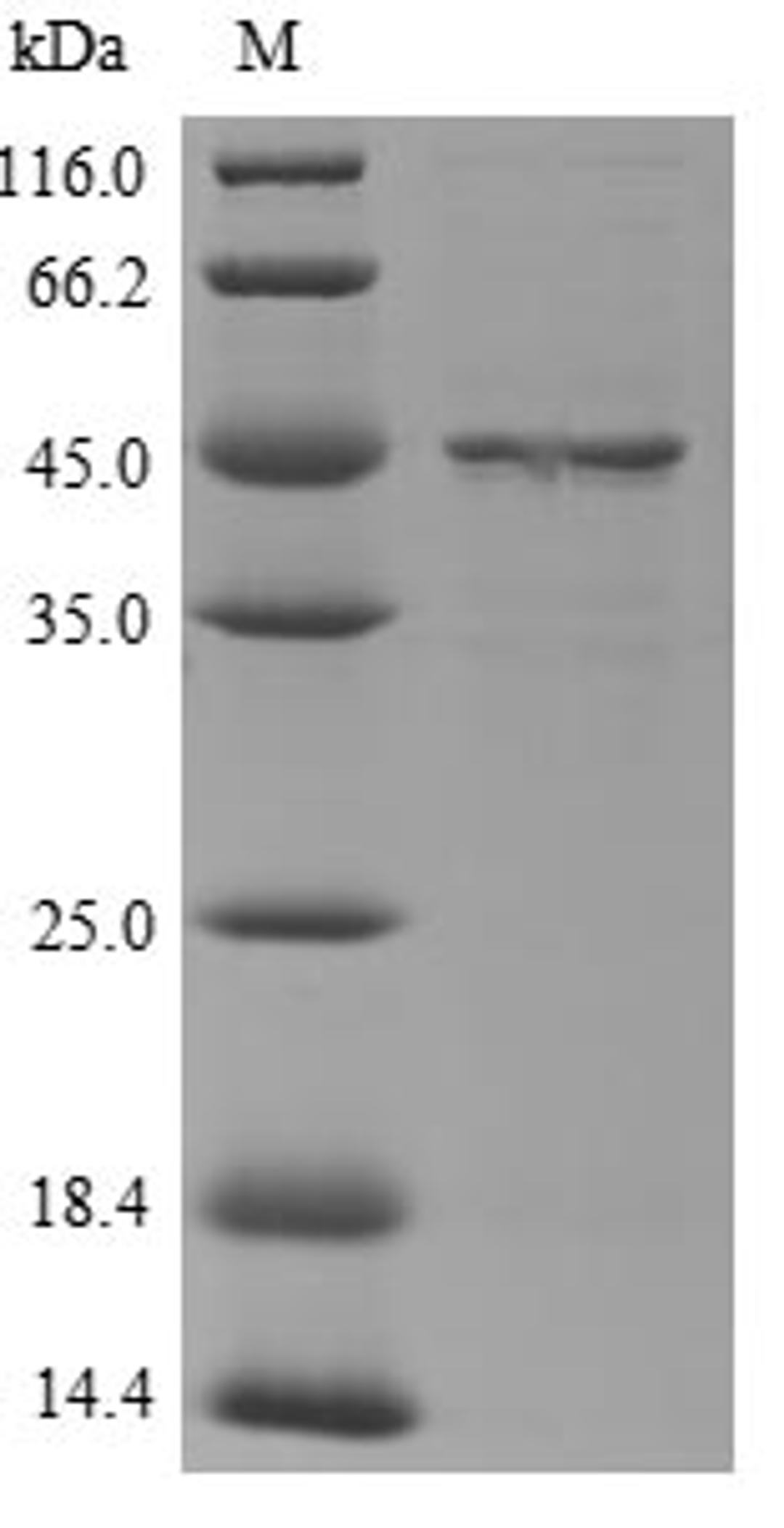 (Tris-Glycine gel) Discontinuous SDS-PAGE (reduced) with 5% enrichment gel and 15% separation gel.