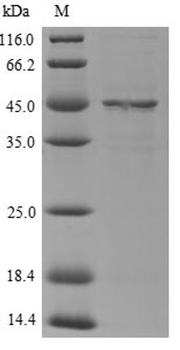 (Tris-Glycine gel) Discontinuous SDS-PAGE (reduced) with 5% enrichment gel and 15% separation gel.