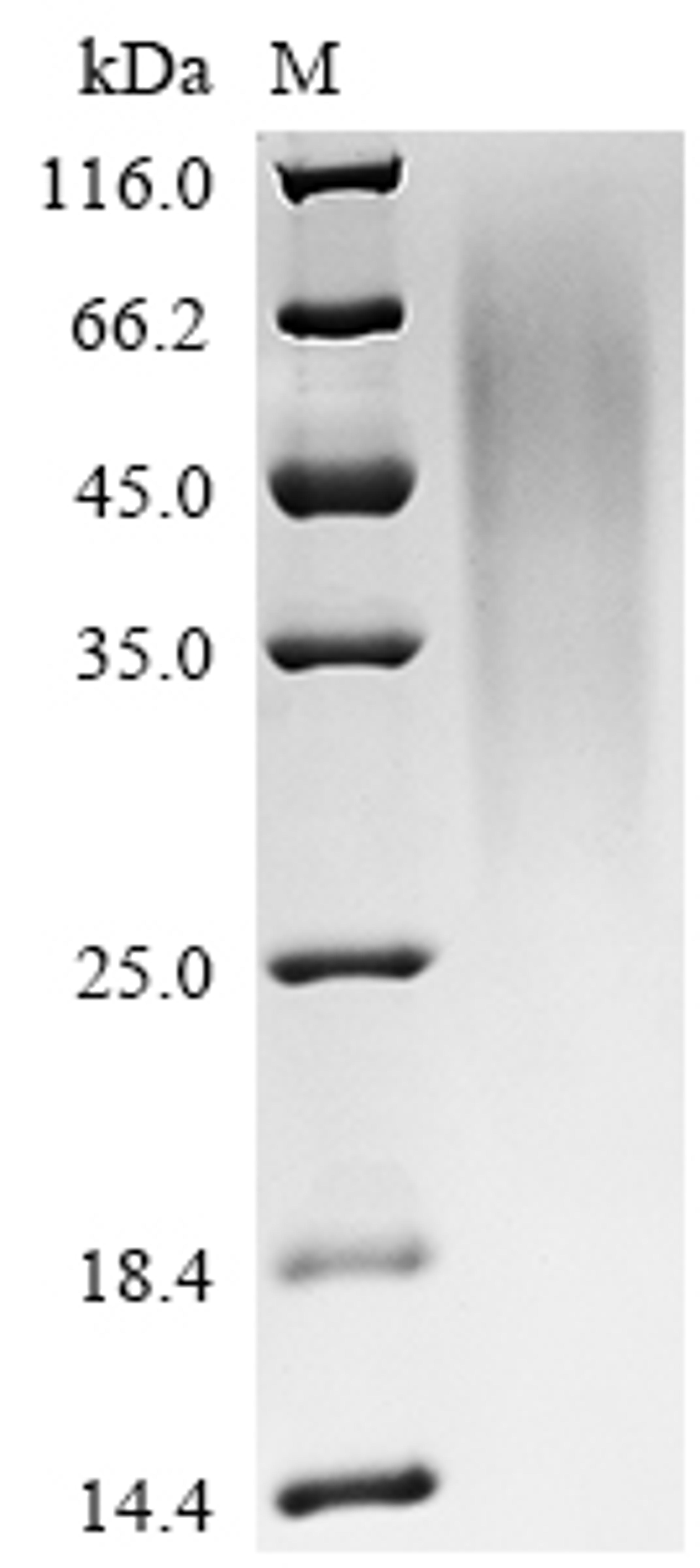 (Tris-Glycine gel) Discontinuous SDS-PAGE (reduced) with 5% enrichment gel and 15% separation gel.