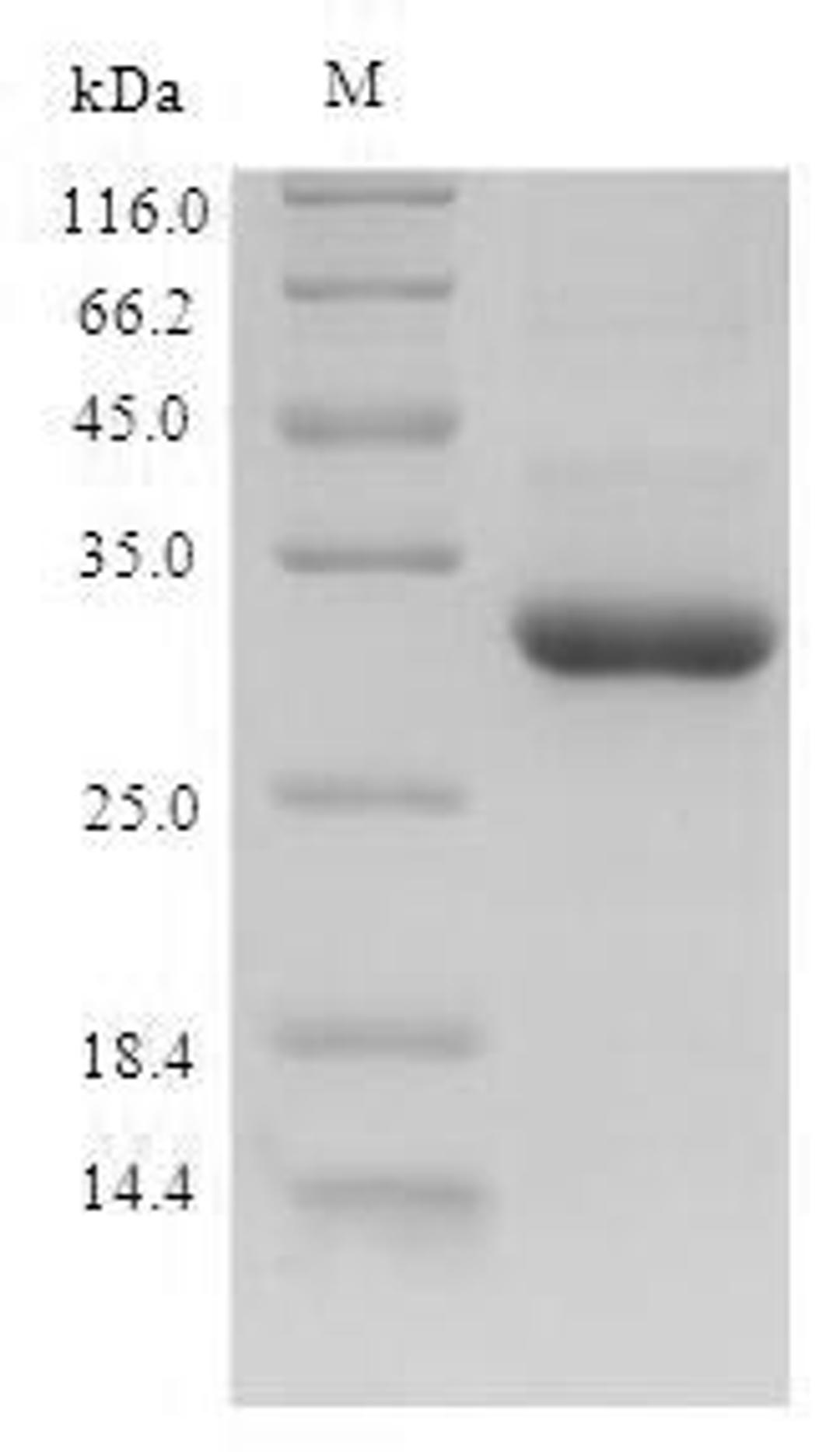 (Tris-Glycine gel) Discontinuous SDS-PAGE (reduced) with 5% enrichment gel and 15% separation gel.