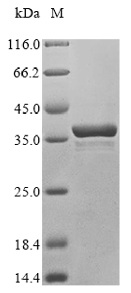 (Tris-Glycine gel) Discontinuous SDS-PAGE (reduced) with 5% enrichment gel and 15% separation gel.