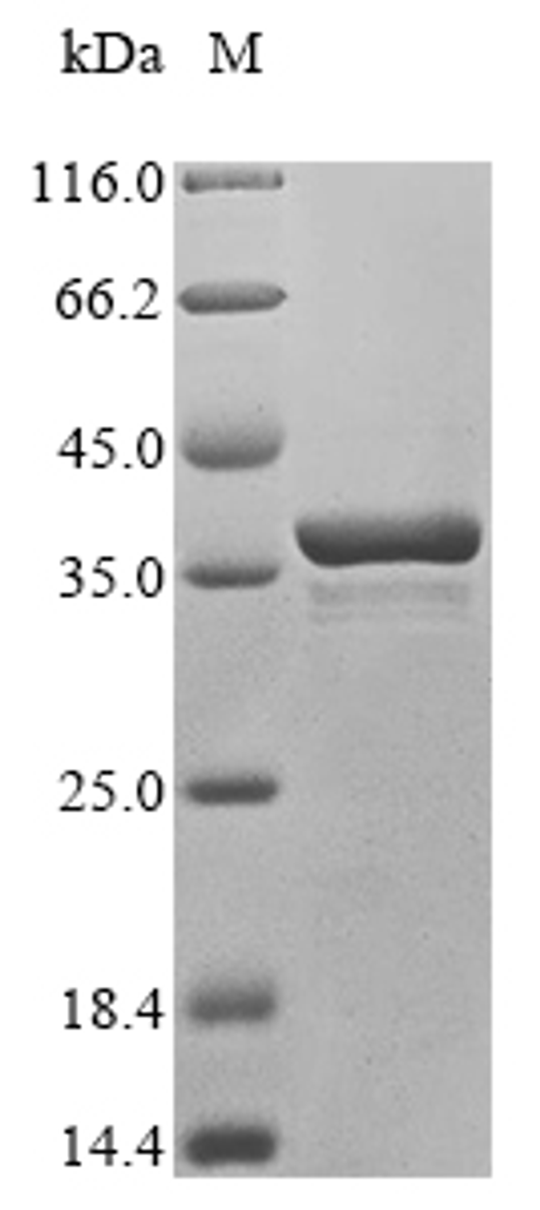 (Tris-Glycine gel) Discontinuous SDS-PAGE (reduced) with 5% enrichment gel and 15% separation gel.