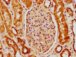 IHC image of CSB-PA884627LA01HU diluted at 1:150 and staining in paraffin-embedded human kidney tissue performed on a Leica BondTM system. After dewaxing and hydration, antigen retrieval was mediated by high pressure in a citrate buffer (pH 6.0). Section was blocked with 10% normal goat serum 30min at RT. Then primary antibody (1% BSA) was incubated at 4&deg;C overnight. The primary is detected by a biotinylated secondary antibody and visualized using an HRP conjugated SP system.