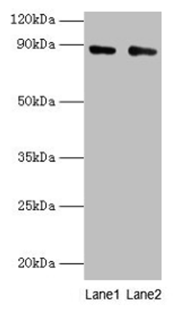 Western blot. All lanes: CFB antibody at 2µg/ml. Lane 1: K562 whole cell lysate. Lane 2: HepG2 whole cell lysate. Secondary. Goat polyclonal to rabbit IgG at 1/10000 dilution. Predicted band size: 86, 69 kDa. Observed band size: 86 kDa