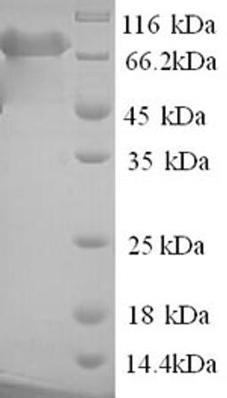 (Tris-Glycine gel) Discontinuous SDS-PAGE (reduced) with 5% enrichment gel and 15% separation gel.